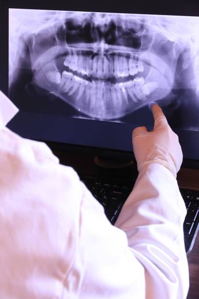 Best Broken or Cracked Tooth Emergency Dentist in Ronkonkoma, NY