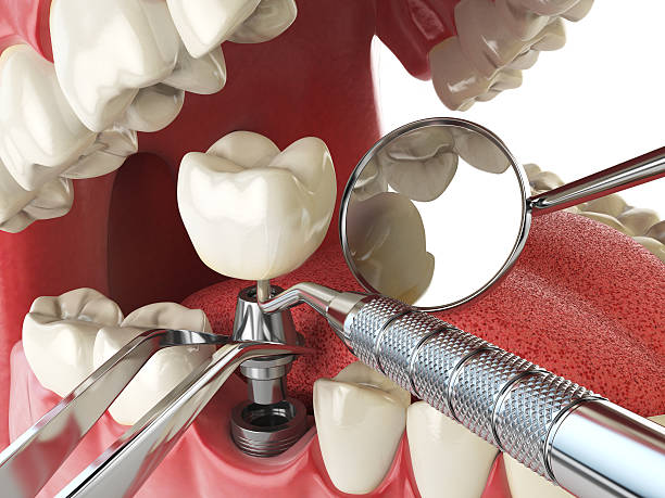 Best Emergency Dentist for Knocked-Out Tooth in Ronkonkoma, NY